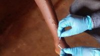 Mpox&nbsp;: l’OMS approuve le premier test de diagnostic pour une utilisation en situation d’urgence
