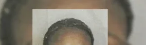 Lambaréné : Une mère de neuf enfants tuée par balle par son ex amant activement recherché
