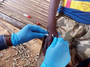 Mpox en Afrique&nbsp;: les enfants particulièrement menacés par la nouvelle variante