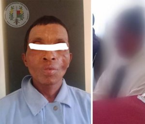 Madagascar&nbsp;: Une jeune fille de 12 ans fait arrêter son violeur de beau-père
